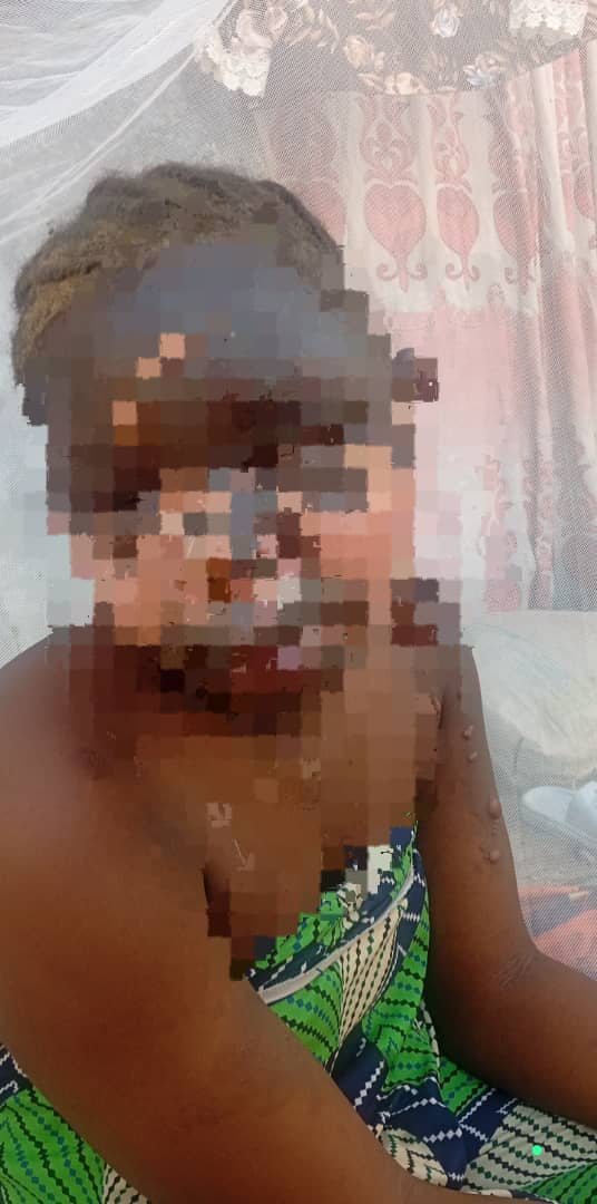 Bride-to-be left fighting for life after stepmother's brutal attack Bride-to-be left fighting for life after stepmother's brutal attack